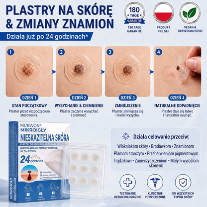 🇵🇱 Wysokiej jakości polski produkt, szybka wysyłka krajowa | MURWON® 🖤 Plastry mikroigłowe zmniejszające widoczność niedoskonałości skóry 📍 (Na włókniaki,kurzajki, pieprzyki, przebarwienia i inne widoczne niedoskonałości skóry.) 🌥️