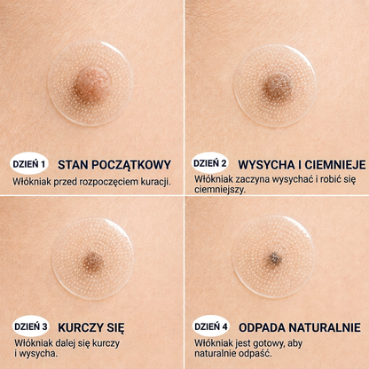 🇵🇱 Wysokiej jakości polski produkt, szybka wysyłka krajowa | MURWON® 💛 Plastry mikroigłowe zmniejszające widoczność niedoskonałości skóry 📍 (Na włókniaki,kurzajki, pieprzyki, przebarwienia i inne widoczne niedoskonałości skóry.) 🌥️