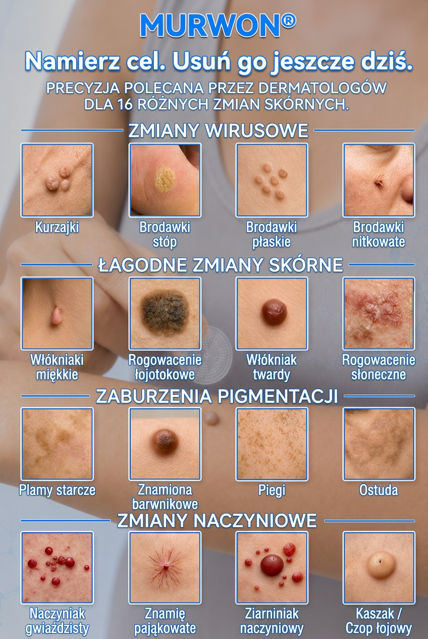 🇵🇱 Wysokiej jakości polski produkt, szybka wysyłka krajowa | MURWON® 💟 Plastry mikroigłowe zmniejszające widoczność niedoskonałości skóry 📍 (Na włókniaki,kurzajki, pieprzyki, przebarwienia i inne widoczne niedoskonałości skóry.) 🌥️