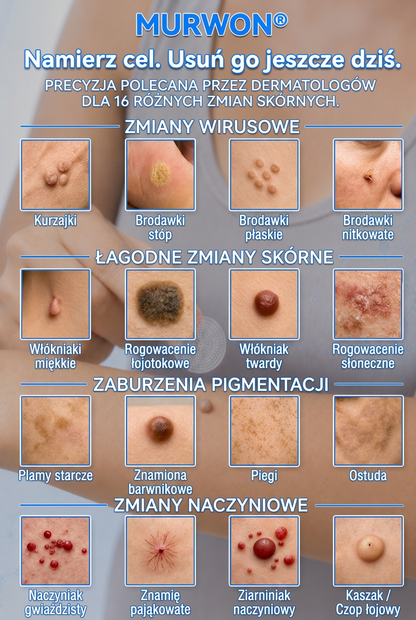 🇵🇱 Wysokiej jakości polski produkt, szybka wysyłka krajowa | MURWON® 💛 Plastry mikroigłowe zmniejszające widoczność niedoskonałości skóry 📍 (Na włókniaki,kurzajki, pieprzyki, przebarwienia i inne widoczne niedoskonałości skóry.) 🌥️